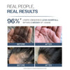 Bare Anatomy Anti-Hair Fall Shampoo