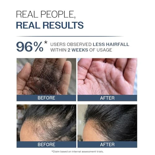 Bare Anatomy Anti-Hair Fall Shampoo